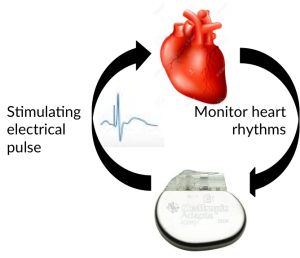 Heart Pacemaker feedback to improve heart regulation